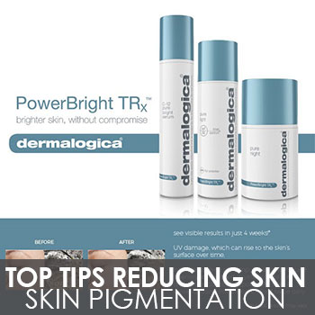 Top Tips For Reducing Skin Pigmentation
